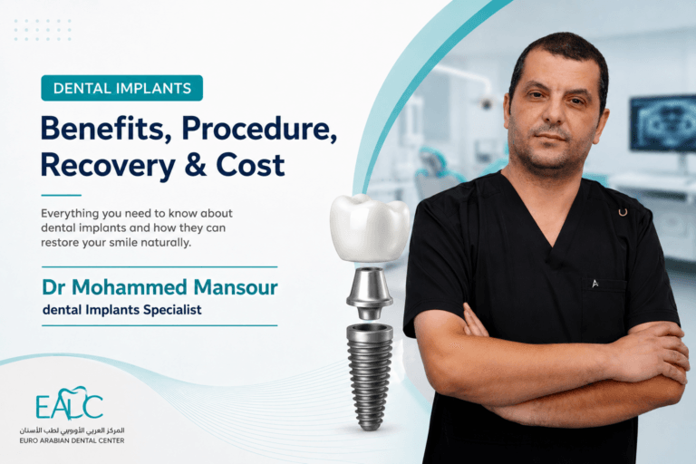All about dental implants