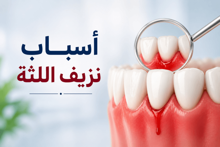 أسباب نزيف اللثة