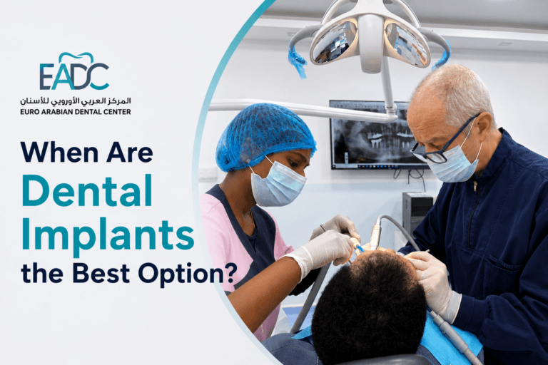 When Are Dental Implants the Best Option?