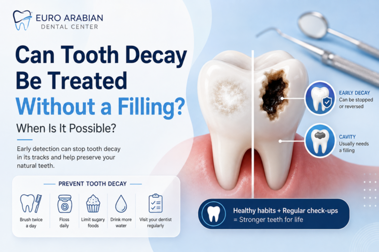 Can tooth decay be treated without a filling? Illustration showing early and advanced tooth decay