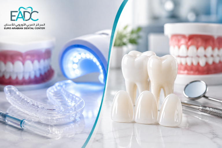 Veneers or teeth whitening for improving your smile